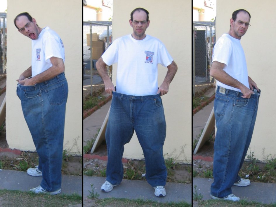 24 months post-surgery - Holding up the size 54 inch pant I wore nearly three years ago.